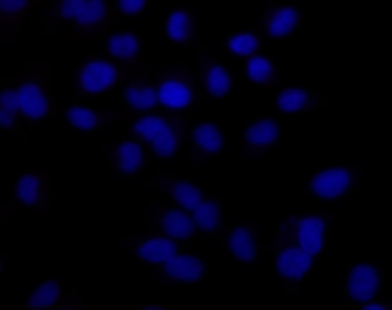 BrdU_A647merge_neg_for_TDS-bmp.png